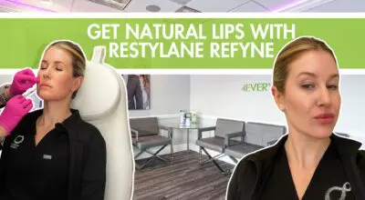 Lip filler apex