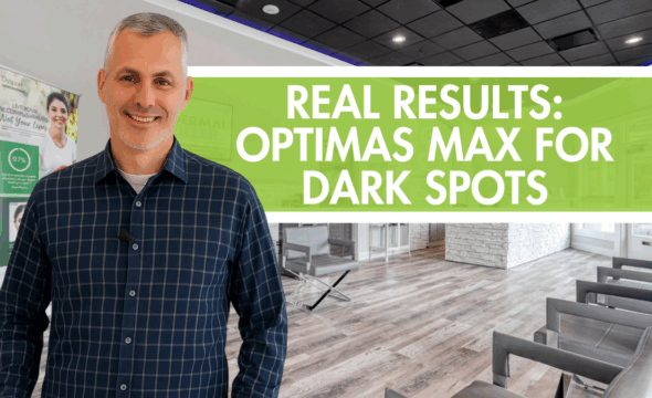  Real Results: Optimas Max for Dark Spots in Midtown Atlanta 