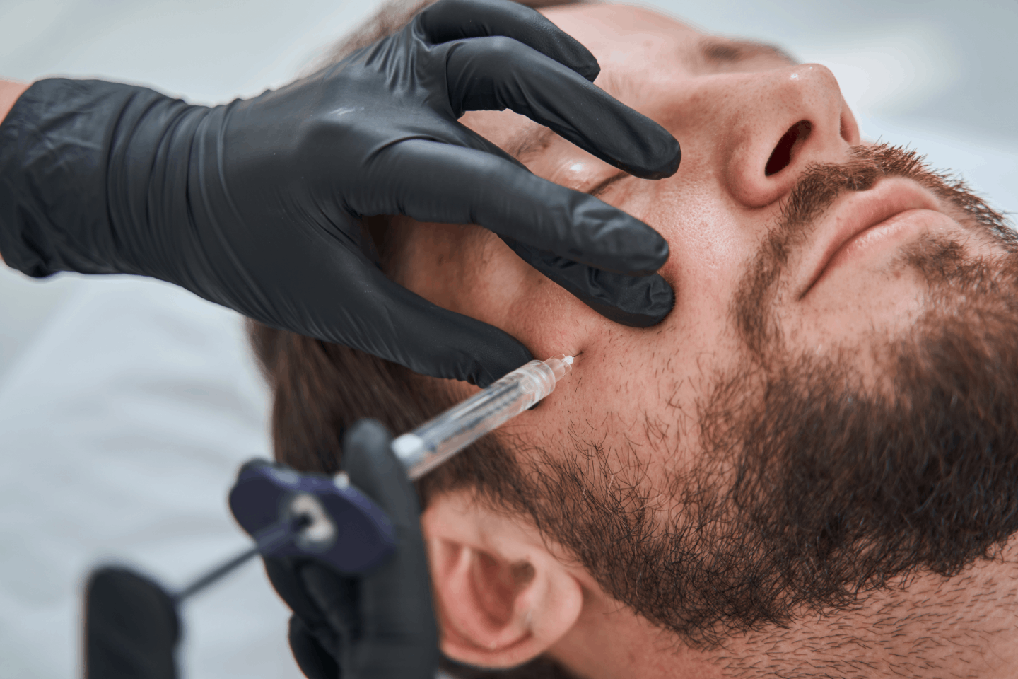 Restylane in Atlanta