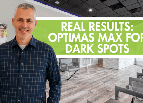 Optimas Max and Morpheus8 for Dark Spots