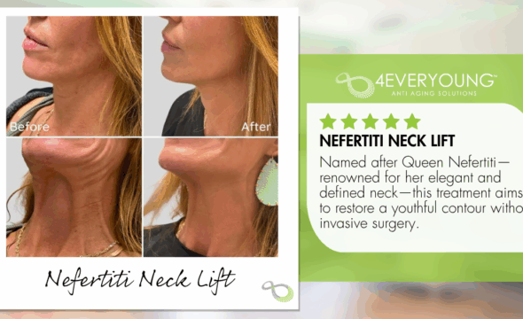  The Nefertiti Neck Lift: Sculpt, Smooth, and Elevate Your Profile—Naturally 