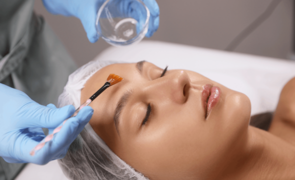 Rejuvenate Your Complexion With a Chemical Face Peel