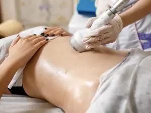 CoolSculpting