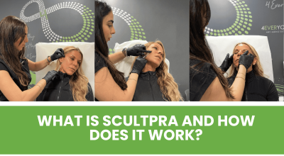 Sculptra in Boca Raton: Lindsay’s 3rd Session Results, the “Sculptra Glow,” and Why It’s the Best Natural Alternative to Filler