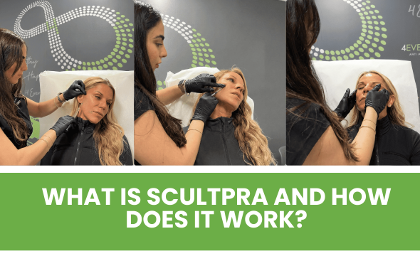  Sculptra in Boca Raton: Lindsay’s 3rd Session Results, the “Sculptra Glow,” and Why It’s the Best Natural Alternative to Filler 