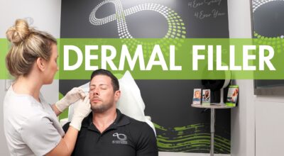 Dermal Filler