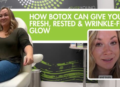 Botox can give you fresh, rested and wrinkle-free glow