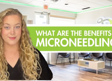 Microneedling