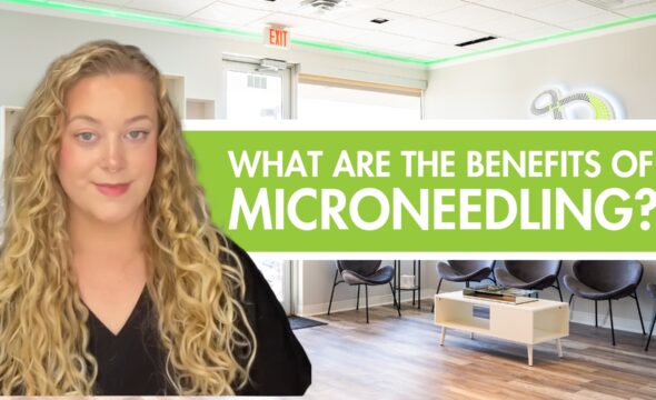  Microneedling 101: What It Is and Why Everyone Loves It 