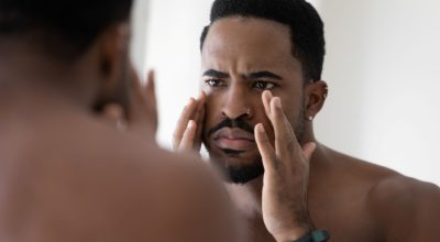 Do Men Get Botox? Breaking the Myth at 4Ever Young Chandler Pavilions