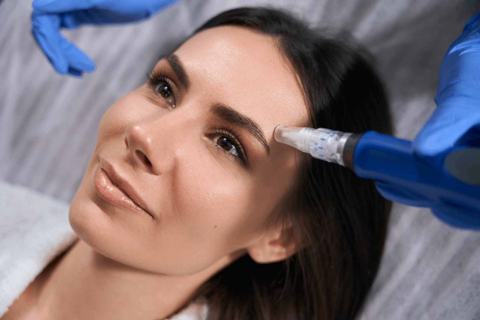SkinPen® Microneedling in Chandler, AZ