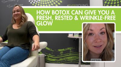 Botox can give you fresh, rested and wrinkle-free glow
