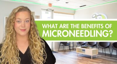 Microneedling