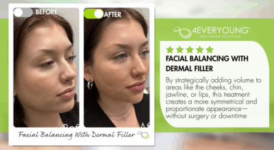 facial balancing with dermal fillers
