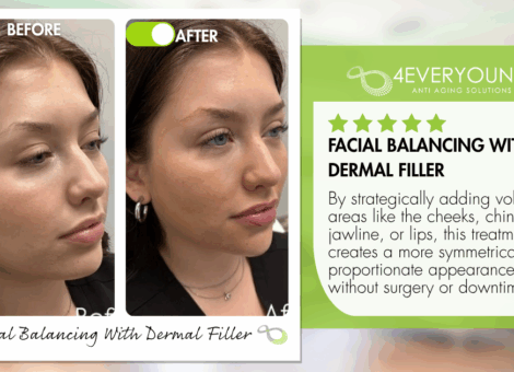 facial balancing with dermal fillers