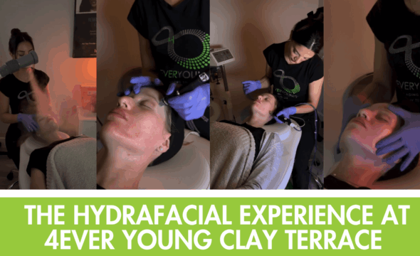 Hydrafacial at 4Ever Young Clay Terrace: Carmel’s Favorite Glow Treatment