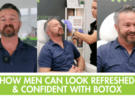 Botox for Men in Colorado Springs | Look Rested & Confident