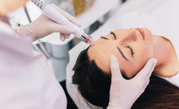 Morpheus8: Deep Skin Rejuvenation with RF Microneedling