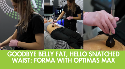 Forma Delray Beach, belly fat reduction Delray, skin tightening Delray, Optimas Max treatment, radiofrequency body contouring