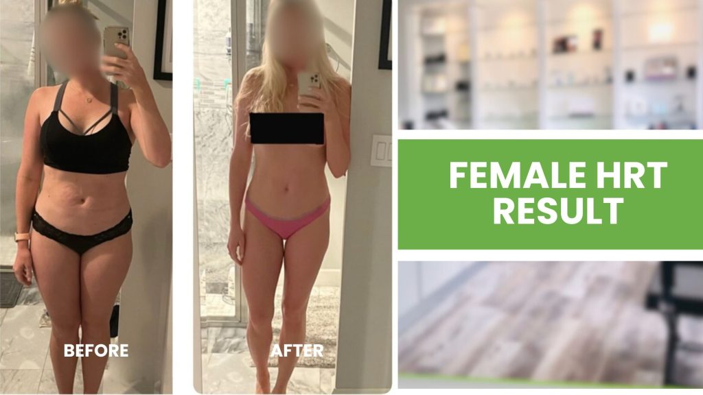 female HRT Delray Beach women’s hormone therapy Delray menopause treatment Delray Beach perimenopause HRT Delray bioidentical hormones Delray Beach 4Ever Young Delray HRT