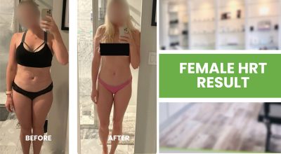female HRT Delray Beach women’s hormone therapy Delray menopause treatment Delray Beach perimenopause HRT Delray bioidentical hormones Delray Beach 4Ever Young Delray HRT