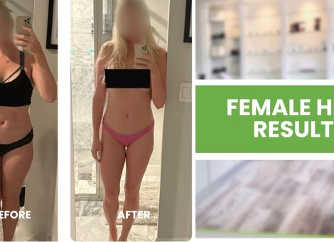 female HRT Delray Beach women’s hormone therapy Delray menopause treatment Delray Beach perimenopause HRT Delray bioidentical hormones Delray Beach 4Ever Young Delray HRT