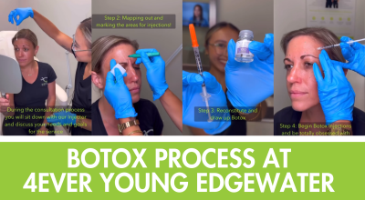 Botox Edgewater, Botox consultation process, natural Botox results, Botox near Hoboken, facial injectables Edgewater
