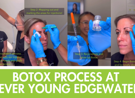 Botox Edgewater, Botox consultation process, natural Botox results, Botox near Hoboken, facial injectables Edgewater