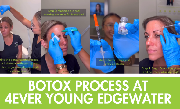  Your Step-by-Step Guide to Getting Botox at 4Ever Young Edgewater 