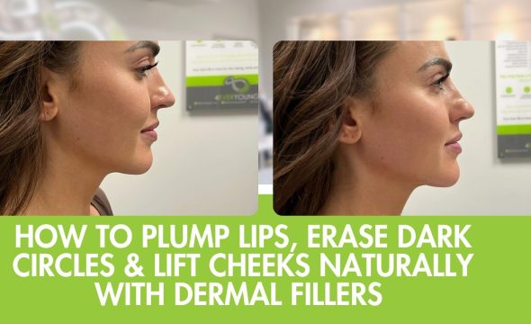  How to Plump Lips, Erase Dark Circles & Lift Cheeks Naturally with Dermal Fillers in Fort Collins 
