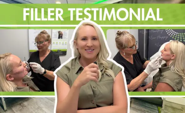  Maria’s Story: How Dermal Fillers Helped Her Rediscover Her Glow at 4Ever Young Fort Lauderdale 