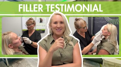 Dermal Filler