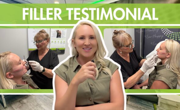  Maria’s Story: How Dermal Fillers Helped Her Rediscover Her Glow at 4Ever Young Fort Lauderdale 