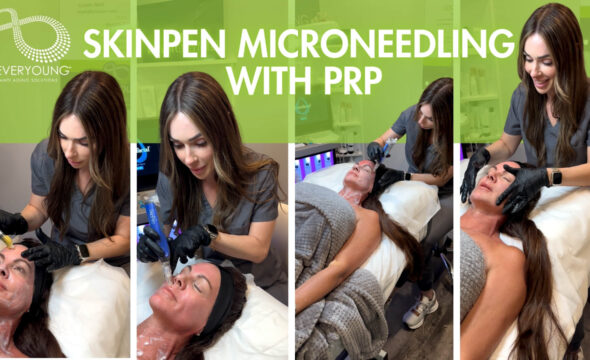 Turn Back Time with SkinPen Microneedling and PRP at 4Ever Young Fort Lauderdale 