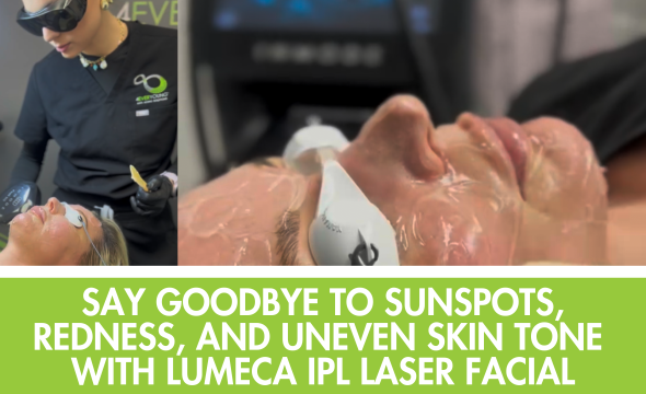  Say Goodbye to Sunspots, Redness, and Uneven Skin Tone with Lumeca IPL at 4Ever Young Frankfort 