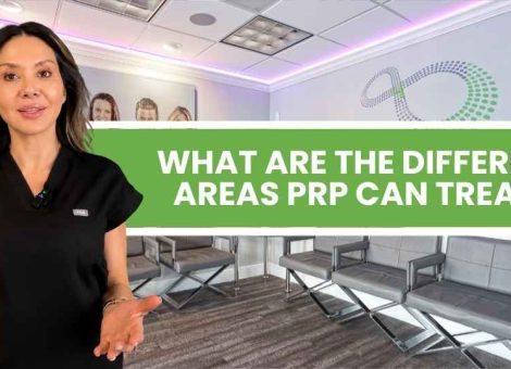 prp therapy