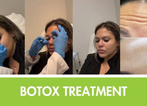 botox near me Hoboken med spa 4Ever young anti aging solutions