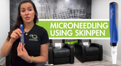 microneedling using skinpen