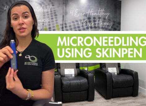 microneedling using skinpen
