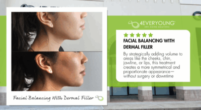 facial balanlcing with restylane