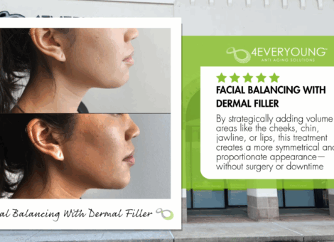 facial balanlcing with restylane