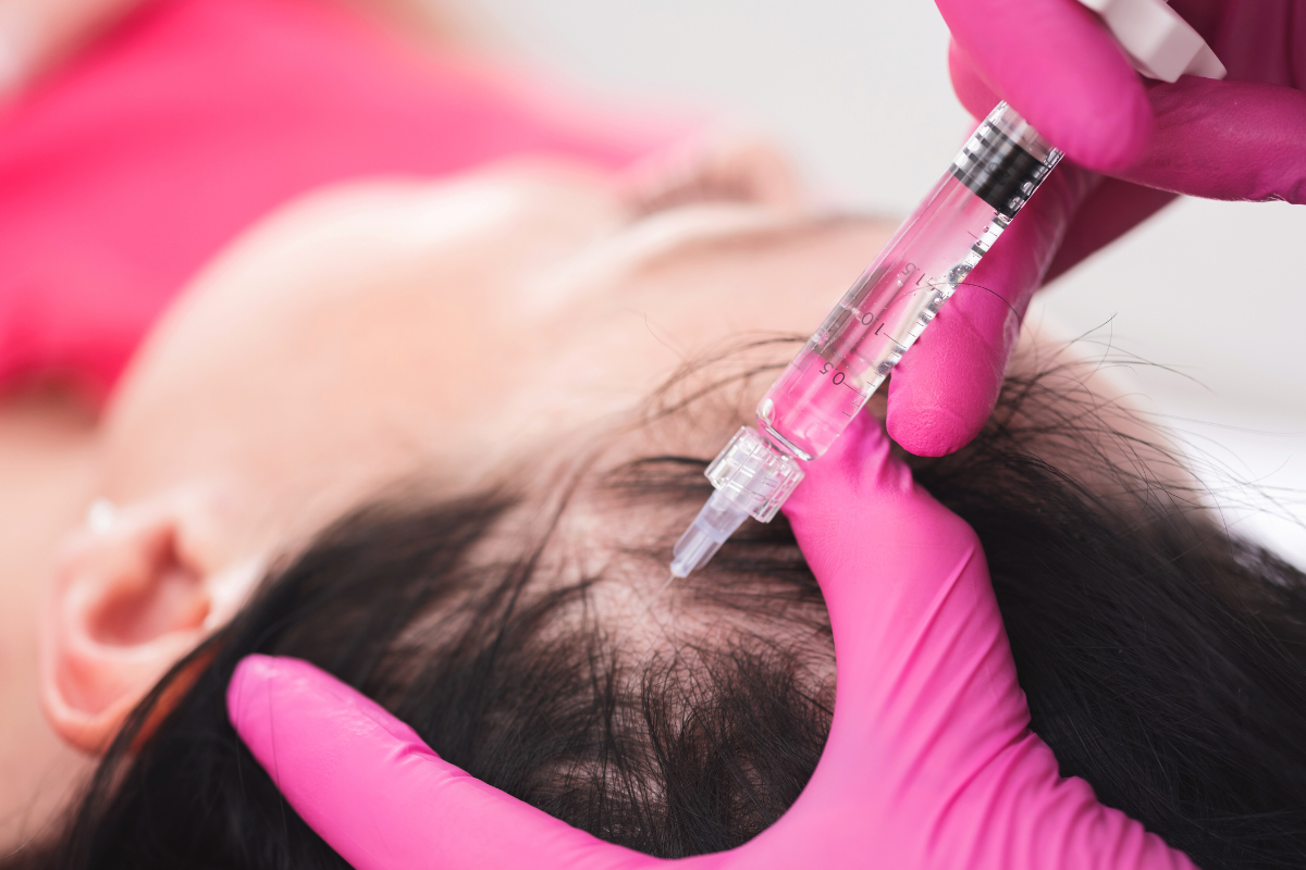 PRP Treatments
