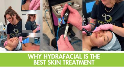 Hydrafacial Johns Creek, best facial for professionals, Hydrafacial near me, skin treatments Johns Creek, non-invasive facial, fast facial for busy people, anti-aging facial, glowing skin treatment Johns Creek, 4Ever Young Hydrafacial, modern facial for professionals