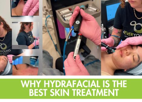 Hydrafacial Johns Creek, best facial for professionals, Hydrafacial near me, skin treatments Johns Creek, non-invasive facial, fast facial for busy people, anti-aging facial, glowing skin treatment Johns Creek, 4Ever Young Hydrafacial, modern facial for professionals