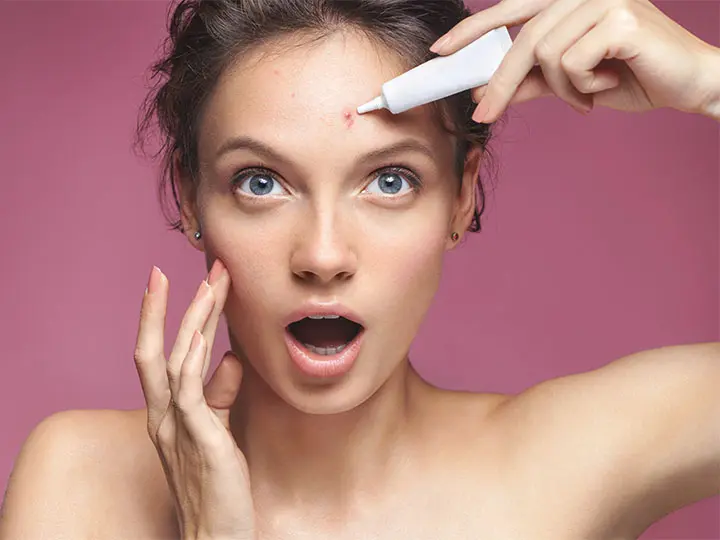 Acne Scar Removal