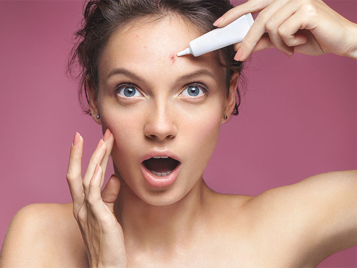 Acne Scar Removal