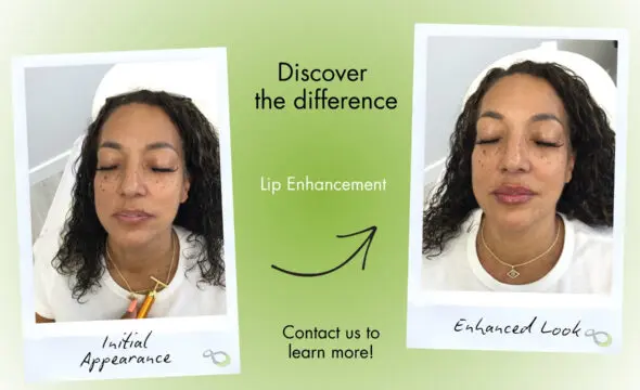  Enhancing Your Smile: The Complete Guide to Lip Augmentation at 4Ever Young Livingston 