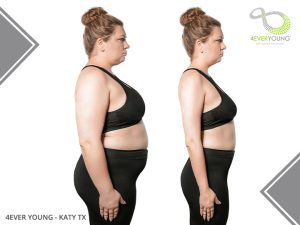 Medical Weight Loss Katy TX