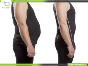 Medical Weight Loss Naples FL