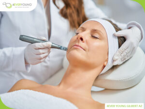 Microneedling Gilbert AZ